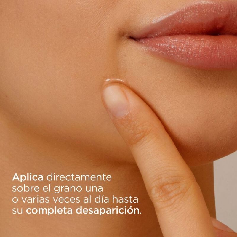 Pack Isdin Tratamiento Acne Completo Gel+ Control Brillo + Limpiador-1747083478769
