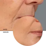 ly_retinol_serum_7_before-after_1738257708_1024x1024