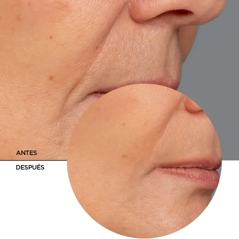 ly_retinol_serum_7_before-after_1738257708_1024x1024
