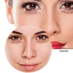 ly_hyaluronic_acid_3_face_wash_7_before-after_1738232293_1024x1024