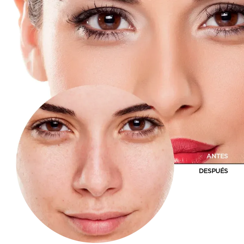 ly_hyaluronic_acid_3_face_wash_7_before-after_1738232293_1024x1024