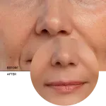 Retinal_7_before-after_b731d611-288d-4645-a942-76e547dc1606_1024x1024