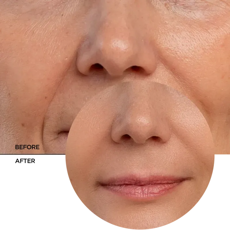 Retinal_7_before-after_b731d611-288d-4645-a942-76e547dc1606_1024x1024