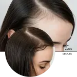 ly_multi_peptides_for_hair_7_before-after_1738233489_1024x1024