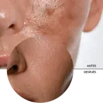 ly_daily_sun_shield_for_oily_skin_7_before-after_1738177430_1024x1024