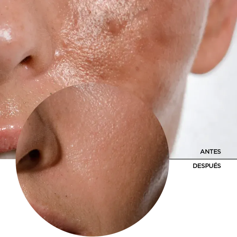 ly_daily_sun_shield_for_oily_skin_7_before-after_1738177430_1024x1024