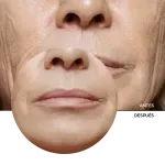 ly_retinol_cream_7_before-after_1738177549_1024x1024