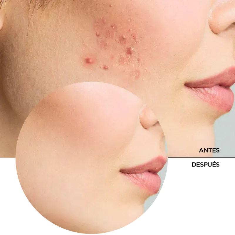 ly_zitcare_face_toner_7_before-after_1738692348_1024x1024