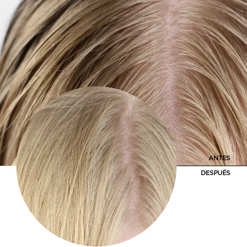 ly_salicylic_acid_2_for_scalp_7_before-after_1738257600_1024x1024