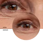 ly_retinol_eye_gel_7_before-after_1738177881_1024x1024