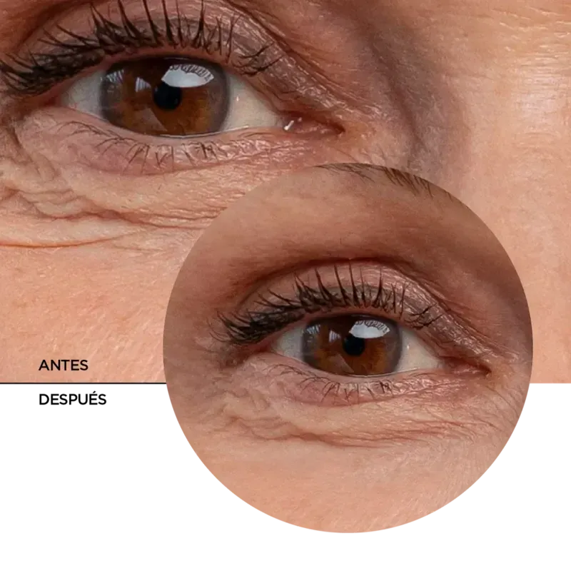 ly_retinol_eye_gel_7_before-after_1738177881_1024x1024