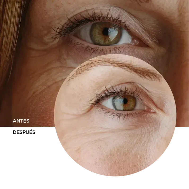 ly_japanese_routine_face_cream_light_texture_7_before-after_1738231061_1024x1024