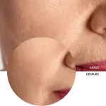 ly_collagen_amino_acids_ha_7_before-after_1738177294_1024x1024