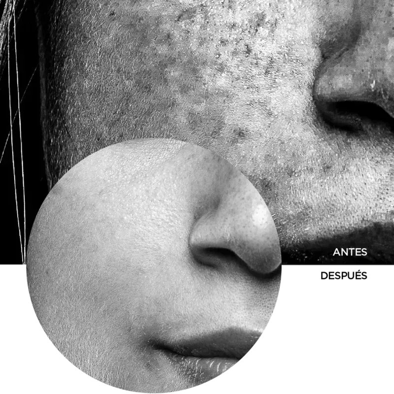 The Clear Set Revox-1748637319069