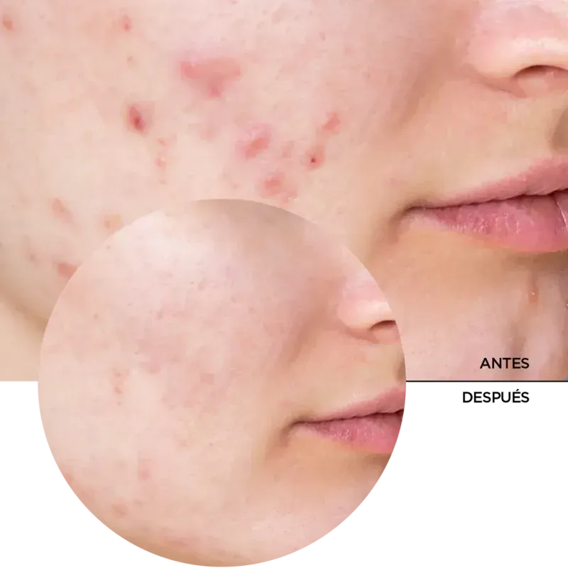 Hyaluronic Power Pair Revox-1748637502635