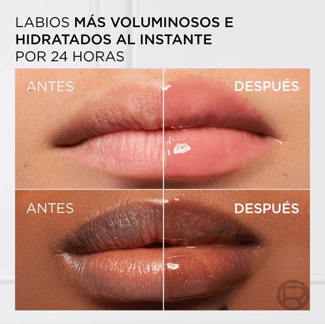 antes-vs-despues