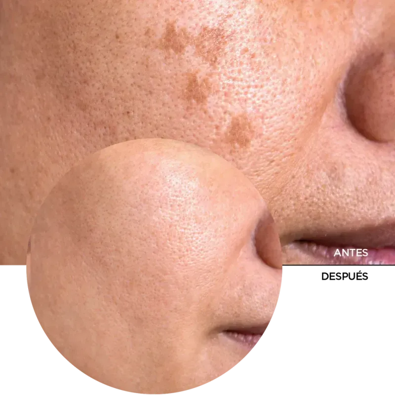 Your Daily Duo - Agua Micelar Limpiadora + Serum de Vitamina C Revox-1749832067842
