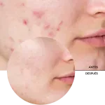 Pack Revox Ácido Glicólico, Ácido Hialurónico y Niacinamida 3X30 ml-1748575432130