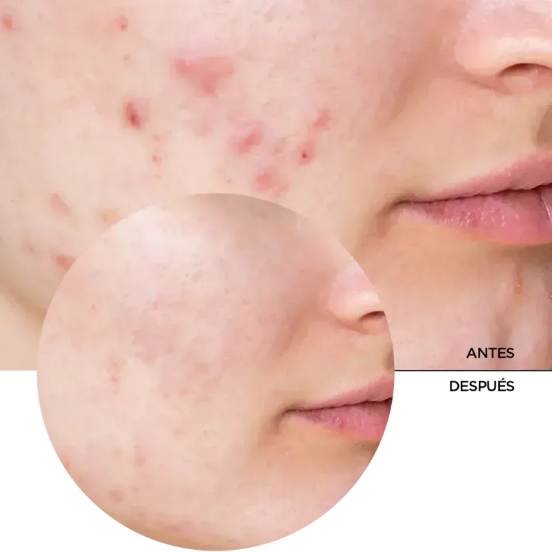 Pack Revox Ácido Glicólico, Ácido Hialurónico y Niacinamida 3X30 ml-1748575432130